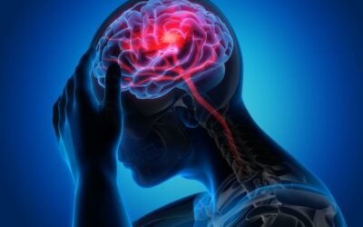 Terapi Nanobubble: Satu Langkah Menuju Penyembuhan bagi Penderita Stroke