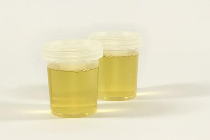 Apakah Urine manusia Bisa Diubah Jadi Pupuk yang Berguna?